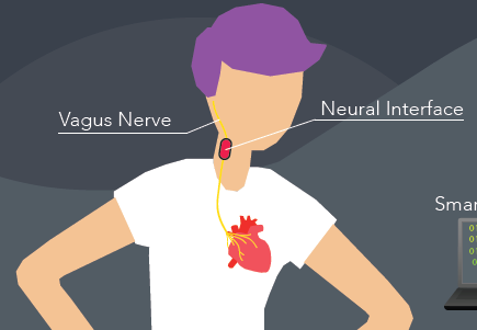Vagus nerve stimulation