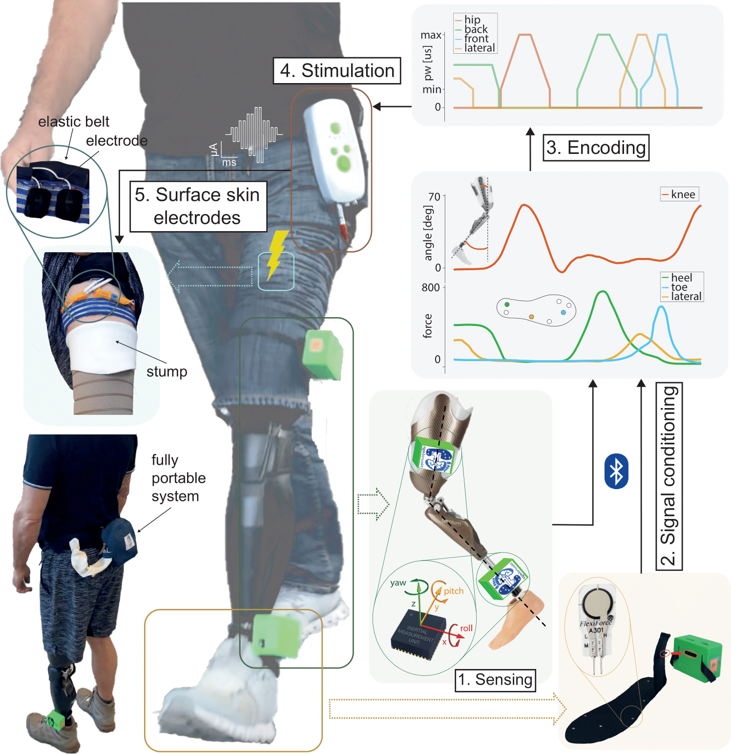 Enlarged view: Overview of the neuroprosthetic legs system: portable and real-time pressure transduction.